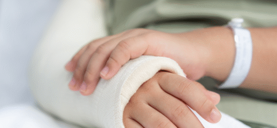 A woman holding her broken and casted arm.